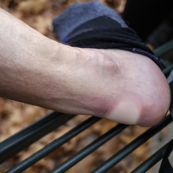 Lifesystems набор пластырей Blister Plasters