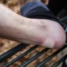 Lifesystems набор пластырей Blister Plasters Фото - 3